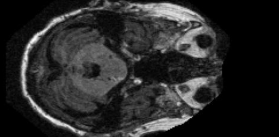 Input MRI — Non Demented