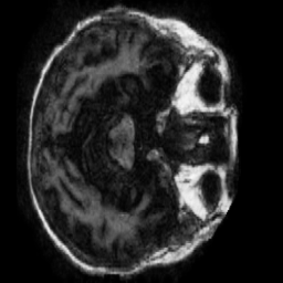 Generated Mild Dementia scan
