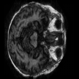 Generated Very Mild Dementia scan