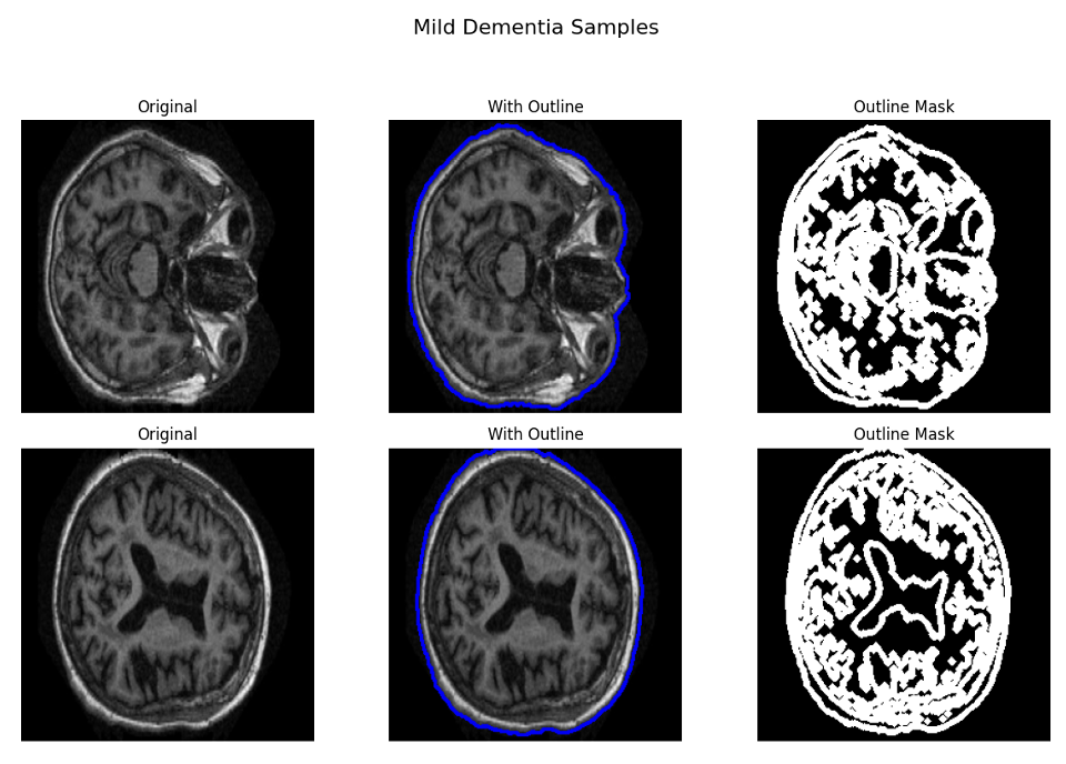 ROI extraction — original, brain outline, and binary mask